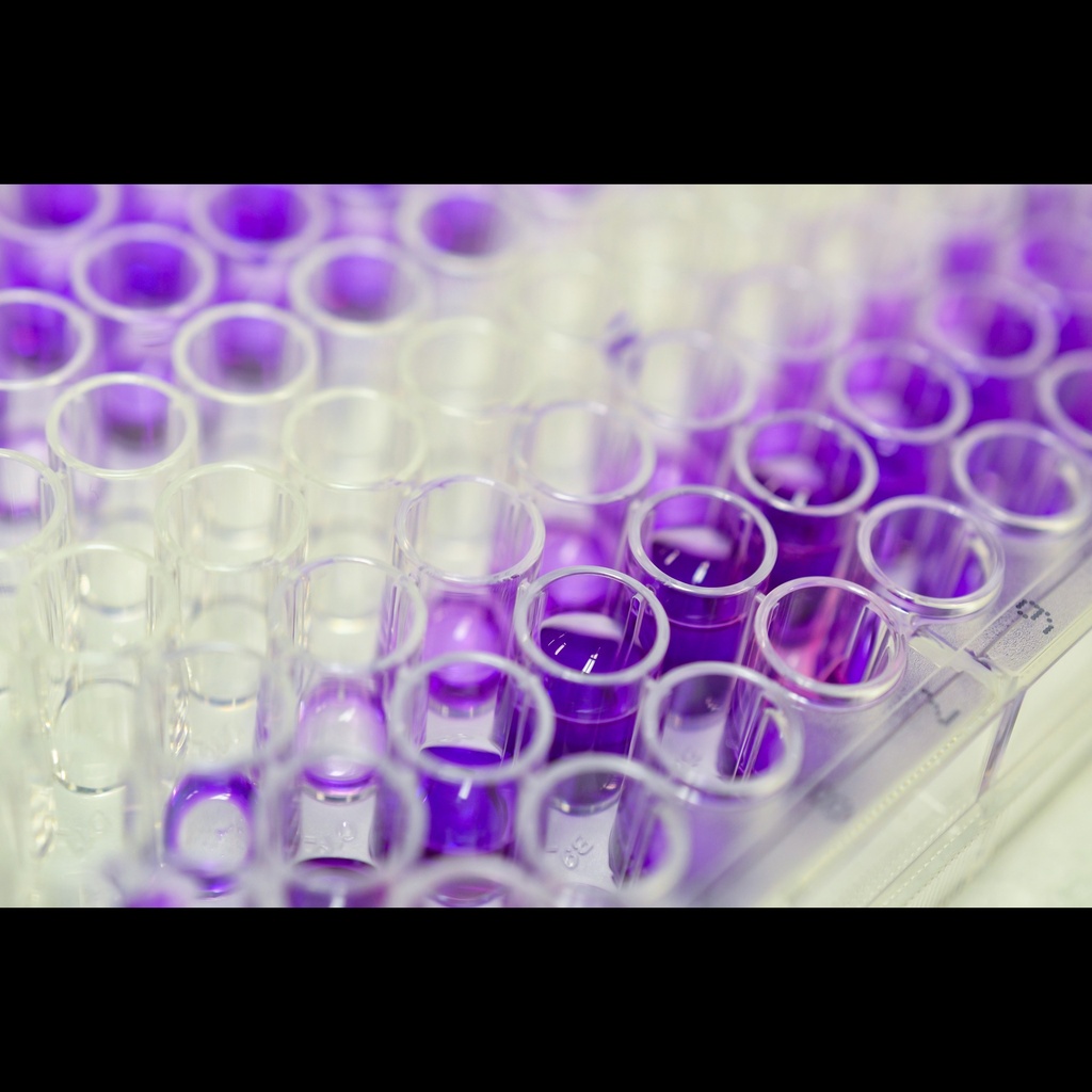 Mouse Interferon/IFNB Elisa Kit 96 Tests